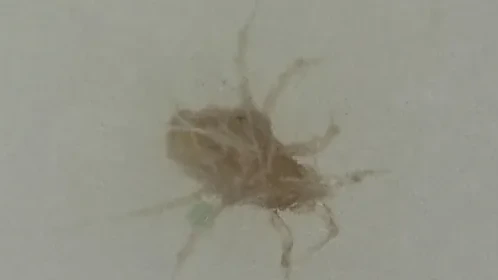 顕微鏡で特定した害虫